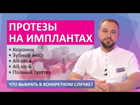 Видео: Протезы на имплантах - зубные коронки, зубной мост, полный протез, all-on-4, all-on-6