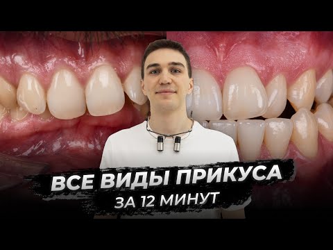 Видео: Все виды прикуса за 12 минут