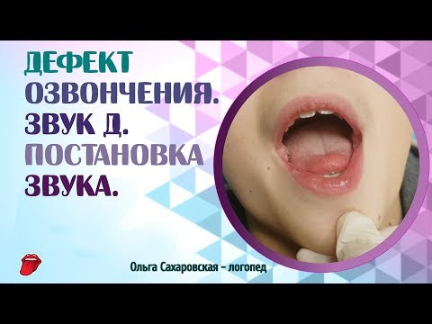 Видео: Дефект озвончения. Звук Д. Что делать, если ребёнок оглушает согласные звуки?