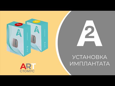 Видео: УСТАНОВКА ИМПЛАНТАТОВ А2