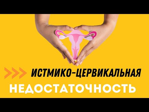 Видео: ИСТМИКО-ЦЕРВИКАЛЬНАЯ НЕДОСТАТОЧНОСТЬ @Dr. Olena Berezovska #olenaberezovska #беременность