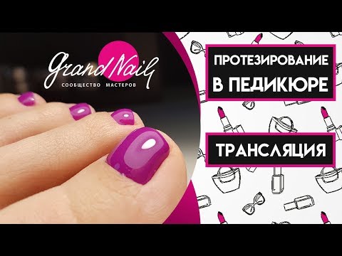 Видео: Протезирование в педикюре - Трансляция Ирины Набок