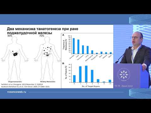 Видео: Лучшее по материалам международных конференций. Рак поджелудочной железы, печени, желчных протоков