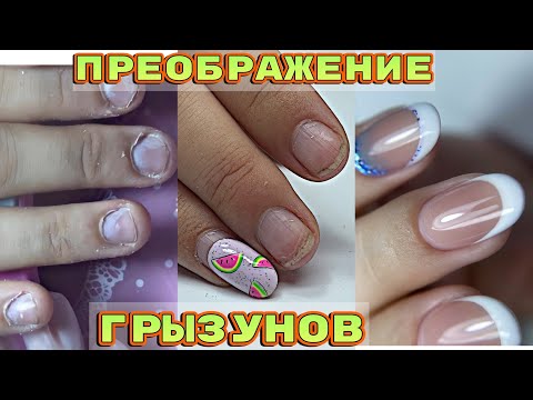 Видео: НОГТИ ГРЫЗУНА спустя 5 лет 🙁 Маникюр френч на овал