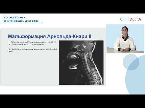 Видео: Spina Bifida  от классификации до маршрутизации
