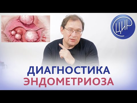 Видео: Эндометриоз. Неинвазивная диагностика ЭНДОМЕТРИОЗА и некодирующая РНК. Гузов И.И.