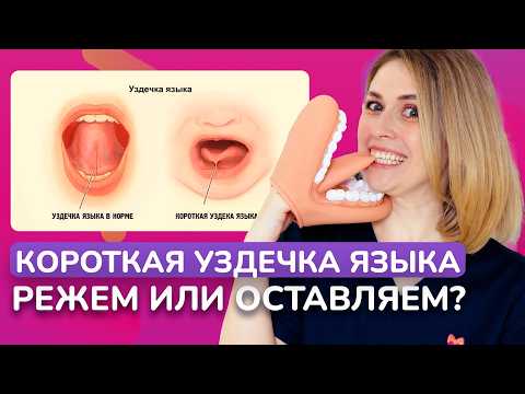Видео: ЭТИ ПРОБЛЕМЫ испортят жизнь вашего ребёнка. Всё из-за короткой уздечки языка