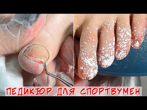 Видео: Комбинированный педикюр / Обработка пальчиков