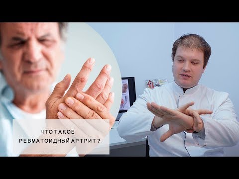 Видео: РЕВМАТОИДНЫЙ АРТРИТ l Что это такое? l Симптомы, Пути лечения