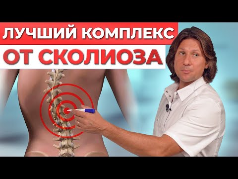 Видео: Как ИЗБАВИТЬСЯ от СКОЛИОЗА в домашних условиях? / Полный комплекс от сколиоза любой степени.