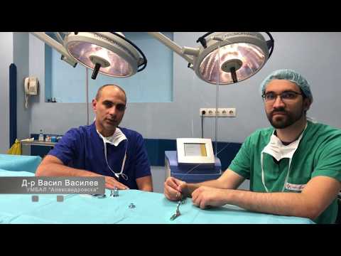 Видео: Лазерно обрязване (циркумцизия) I Laser circumcision