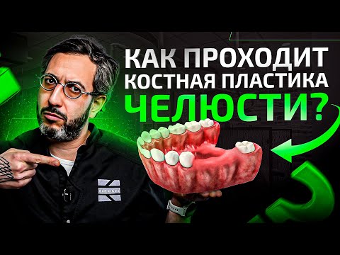 Видео: Все о костной пластике челюсти при имплантанции зубов простыми словами за 11 минут