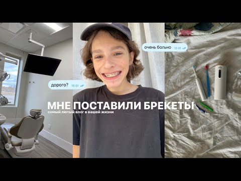 Видео: влог: поставил брекеты🦷🪥// сколько стоит? больно?!?