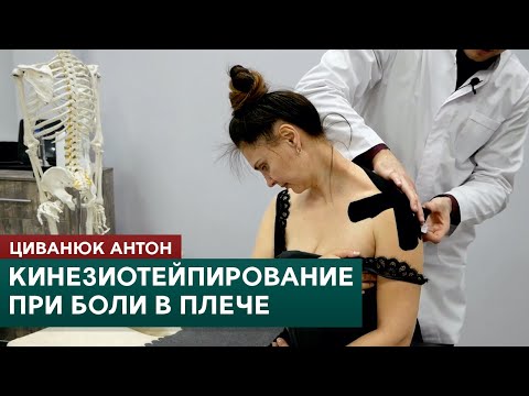 Видео: Кинезиотейпирование при боли в плече. Циванюк Антон