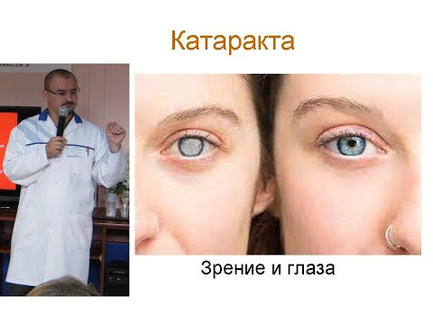 Видео: Помутнение хрусталика – катаракта. Её лечение.