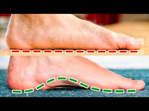 Видео: Этим ОПАСНО плоскостопие У ВЗРОСЛЫХ! / Как ВОВРЕМЯ определить и лечить плоскостопие?