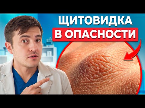 Видео: Как кожа предупреждает о ПРОБЛЕМАХ С ЩИТОВИДКОЙ? Заметь, пока не поздно!