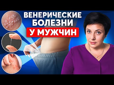 Видео: Как распознать ИНФЕКЦИИ передающиеся половым путем? СИМПТОМЫ У МУЖЧИН