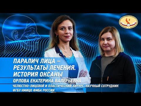 Видео: Паралич лица - результаты лечения. История Оксаны.