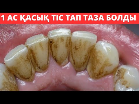 Видео: 1 АС ҚАСЫҚ ҮЙ ЖАҢҒДАЙЫНДА ҚАЛАЙ ТЕЗ ТІСТЕГІ НАЛЕТТІ КЕТІРЕМІЗ.Тіс ағарту
