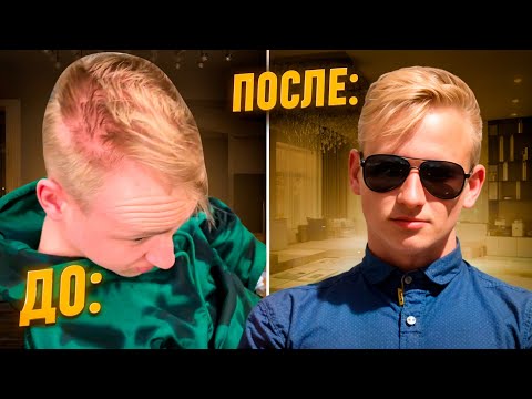 Видео: ЛУЧШИЙ ПРЕПАРАТ ПРОТИВ ОБЛЫСЕНИЯ | ФИНАСТЕРИД