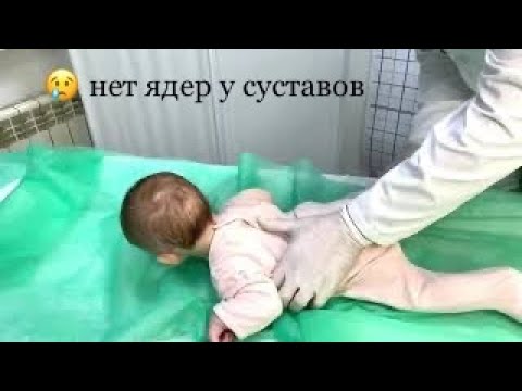 Видео: 😢Нет ядер окостенения у ребёнка, ядра отстают  в развитии. Дисплазия и детский врач!
