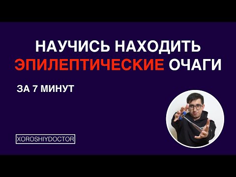 Видео: Научись находить эпилептические очаги за 7 минут