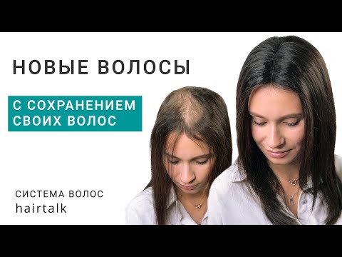 Видео: Фиксация системы волос с сохранением оставшихся волос при женской алопеции.
