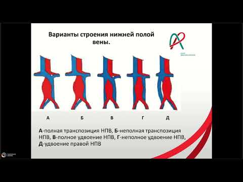 Видео: Аномалии системного венозного возврата