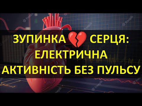 Видео: ЗУПИНКА КРОВООБІГУ: ЕЛЕКТРИЧНА АКТИВНІСТЬ БЕЗ ПУЛЬСУ. ОСОБЛИВОСТІ РЕАНІМАЦІЙНИХ ЗАХОДІВ