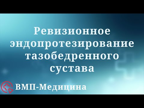 Видео: Ревизионное эндопротезирование тазобедренного сустава | ВМП-Медицина