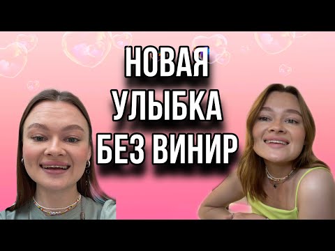 Видео: НАРАЩИВАНИЕ ЗУБОВ | БЕЗ ВИНИР  | ЧТО ЭТО | ЦЕНЫ
