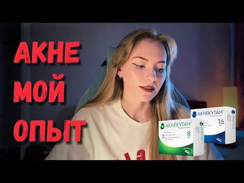 Видео: Как избавиться от акне навсегда: мой опыт и работа с дерматологом
