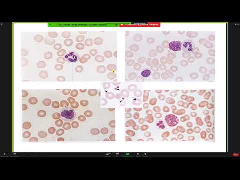 Видео: Консультация ко 2 коллоквиуму - Кутукова К.А.