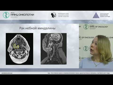 Видео: МРТ лимфоузлов шеи