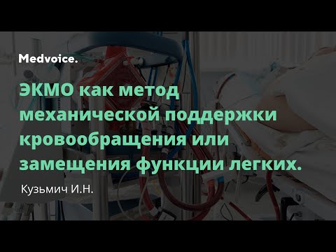 Видео: ЭКМО как метод механической поддержки кровообращения или замещения функции легких. Кузьмич И.Н.