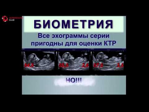 Видео: Биометрия. Так просто -- так сложно. Часть №3 - А.Ю. Блинов, Челябинск