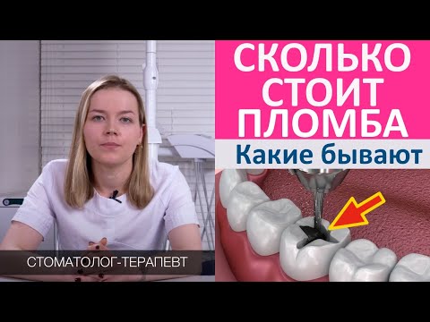 Видео: Зубная пломба - цена, какие виды пломб для зубов бывают. От чего зависит стоимость пломбы.