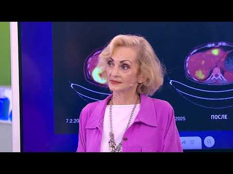 Видео: Цитокиногенетическая терапия при неоперабельном раке желудка IV стадии с метастазами в печень 