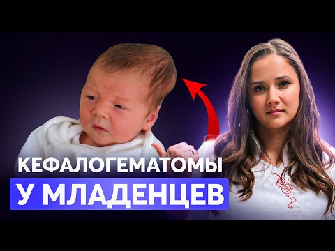 Видео: КЕФАЛОГЕМАТОМА У МЛАДЕНЦА: Когда паниковать, а когда просто наблюдать?