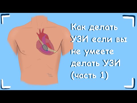 Видео: Как делать УЗИ если вы не умеете делать УЗИ (часть 1)