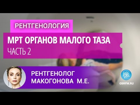 Видео: Рентгенолог Макогонова М.Е.: МРТ органов малого таза. Часть 2