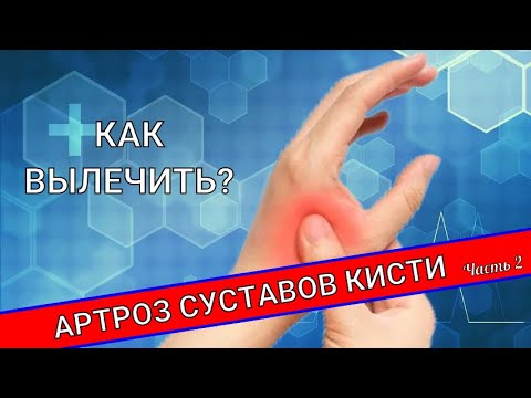 Видео: АРТРОЗ СУСТАВОВ КИСТИ. Лечение (Часть 2)