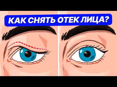 Видео: ПРОСТЫЕ и ЭФФЕКТИВНЫЕ упражнения от отеков на ЛИЦЕ! / Как избавиться от отечности?