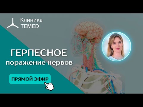 Видео: Прямой эфир "Герпесное поражение нервов"