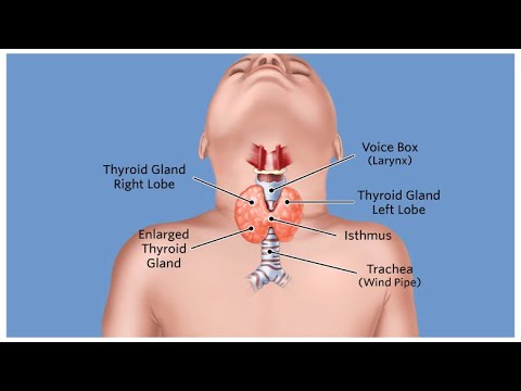 Видео: Щитовидная железа - ключ к решению проблем со здоровьем у детей с СД