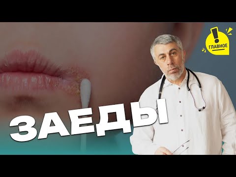 Видео: Заеды