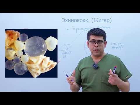 Видео: эхинококкоз