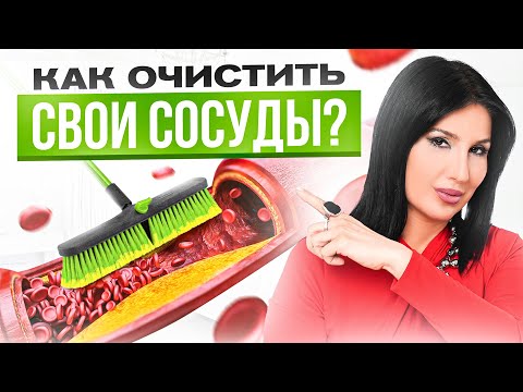Видео: Секрет лечения сосудистых бляшек, о котором вам не рассказывают врачи! (кардиолог раскрыл секрет)