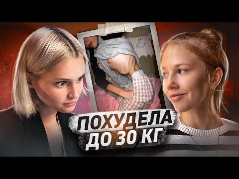 Видео: РПП: анорексия и булимия | ВЕСИЛА 30 кг